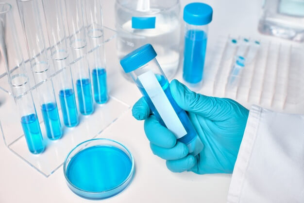 liquid sample gloved female hand blue liquid samples glass plastic tubes 87646 3031