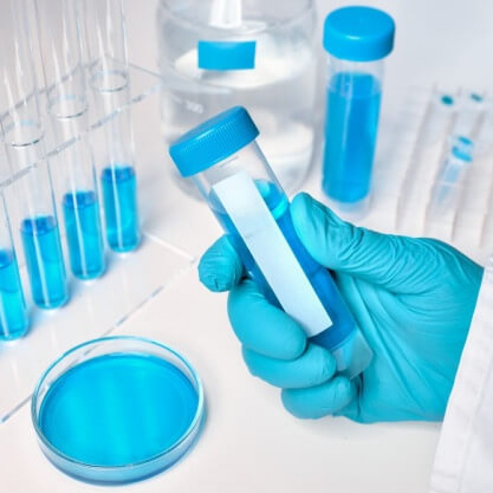 liquid-sample-gloved-female-hand-blue-liquid-samples-glass-plastic-tubes_87646-3031
